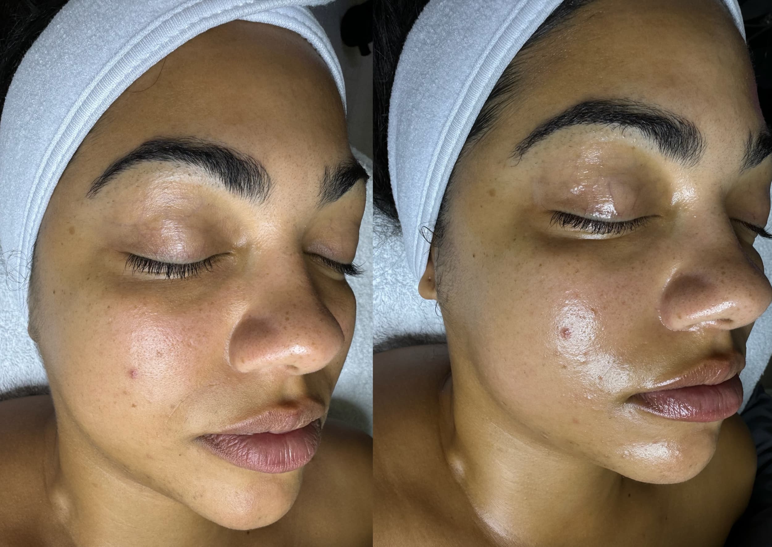 Buccal Massage
